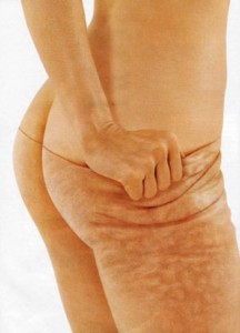 truth-about-cellulite